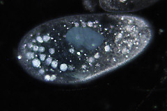 Paramecium in darkfield illumination